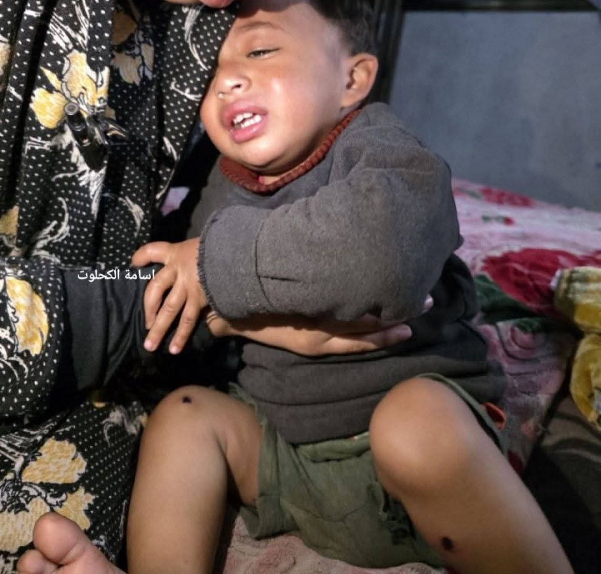 تفاصيل تعذيب الاحتلال لطفل في غزة لم يتجاوز العامين امام والده